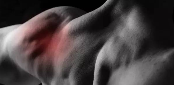 为什么训练后肌肉会酸痛?